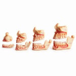 Dentition Development